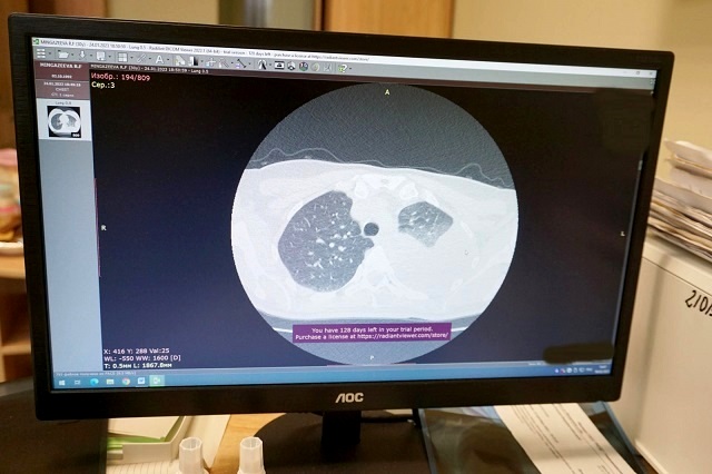 Два литра жидкости откачали врачи РТ из легких девушки, сломавшей ребра на катке