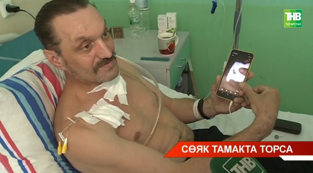 Тамагына сөяк тыгылып калган авыруга катлаулы операция үзенчәлекләре