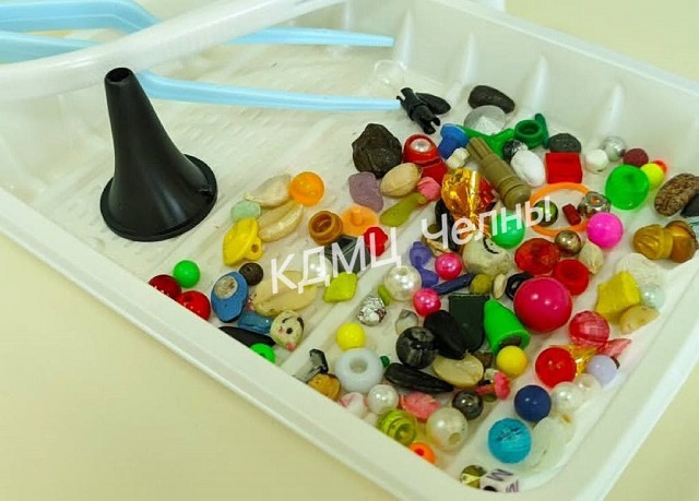 Детали от конструктора, орехи и магниты вытащили врачи в Татарстане из ушей детей