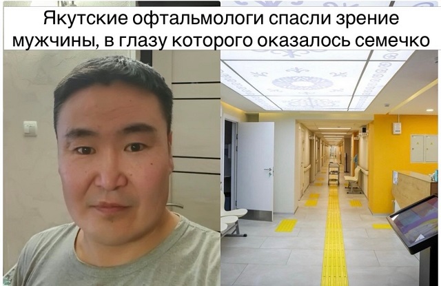 В глаз мужчины из Якутии попало семечко растения и пустило там корни