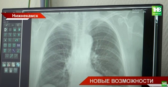 Флюорограф с максимальной точностью снимков поступил в Нижнекамскую ЦРМБ по нацпроекту