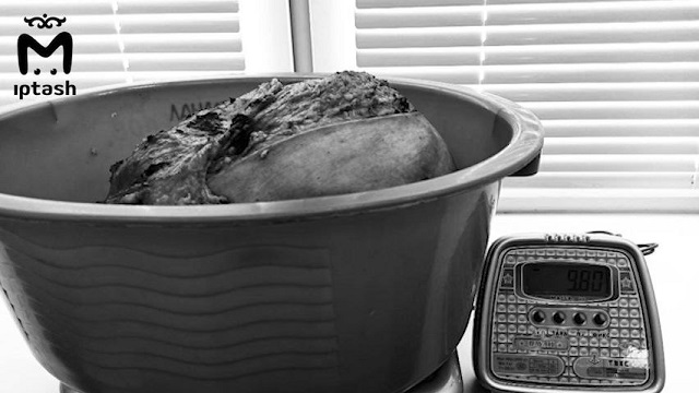 В Набережных Челнах хирурги удалили женщине внезапно выросшую гигантскую опухоль