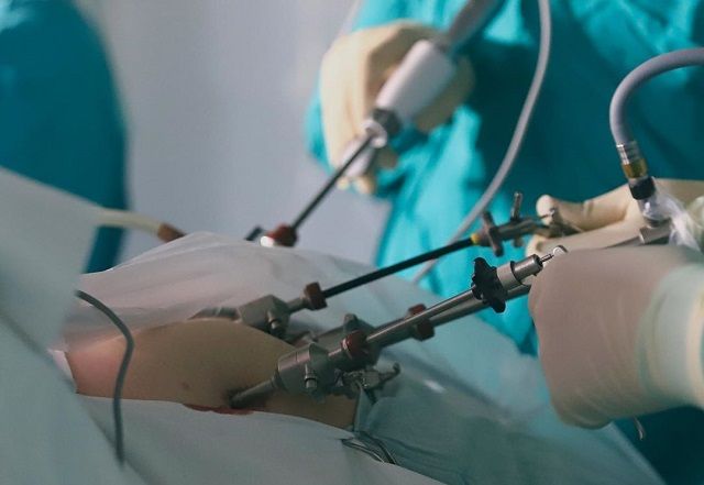 В Татарстане освоили новый способ удаления раковой опухоли