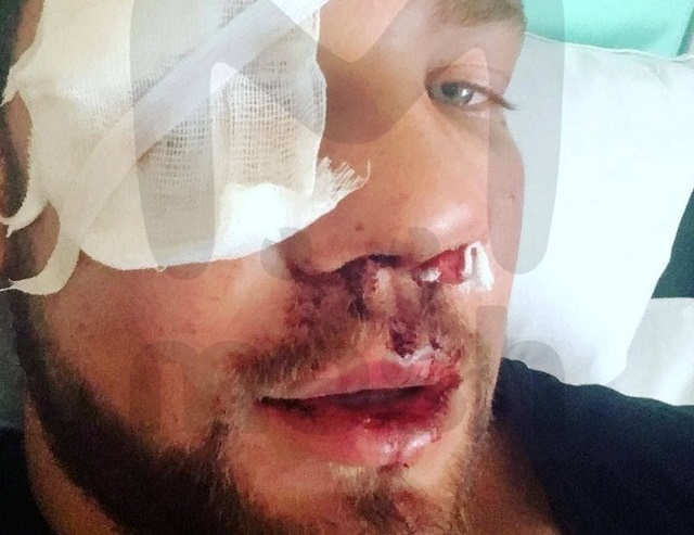 Бастрыкин взял на контроль расследование жестокого избиения мужчины в метро 