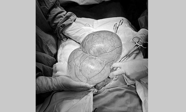 В Татарстане у 32-летней женщины внезапно вырос огромный живот, потребовалась помощь врачей РКБ