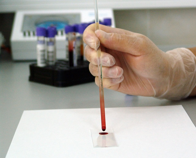 В РТ для детей с онкозаболеваниями провели операцию по трансплантации стволовых клеток