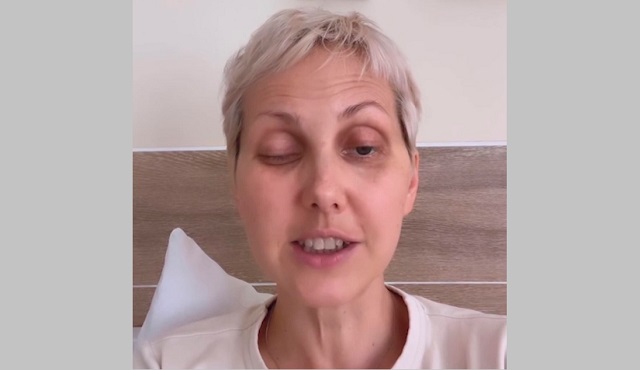 Заболевшая ботулизмом жительница Казани рассказала о последствиях отравления