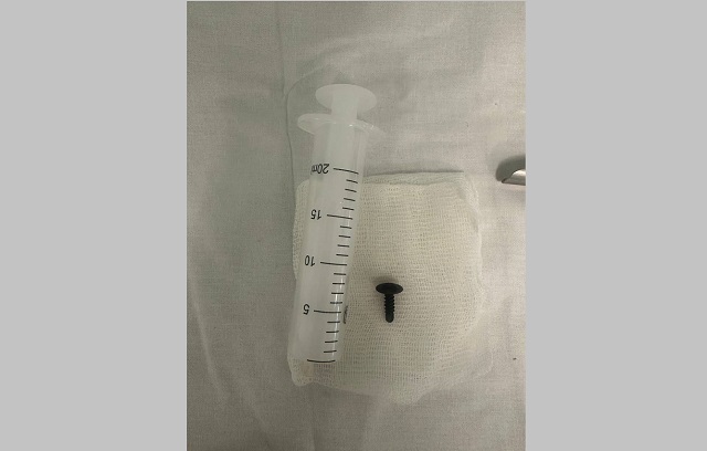 Думали, воспаление легких: врачи РКБ спасли 25-летнего парня, вдохнувшего саморез