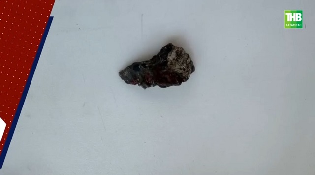 На это не решались врачи из других городов: в РКБ удалили осколок из лица бойца СВО