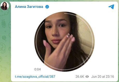 Алина Загитова пожаловалась на проблемы с глазами