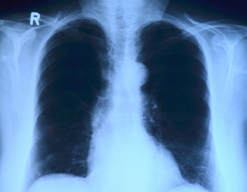 В Татарстане за сутки выявлено 30 случаев коронавируса