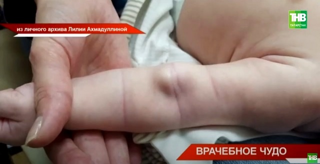 Стало известно, в чем уникальность операции врачей ДРКБ, попавшей в Книгу рекордов РФ