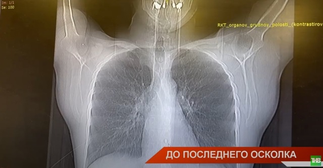 До последнего осколка: в Казани на базе РКБ открыли военный госпиталь