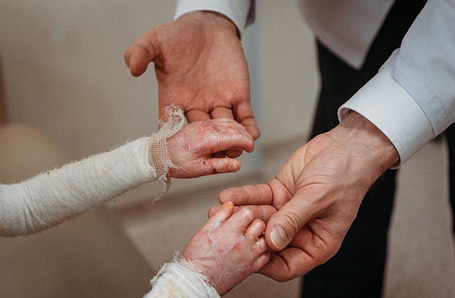 Детский Центр генных дерматозов планируют открыть в Казани весной 2024 года