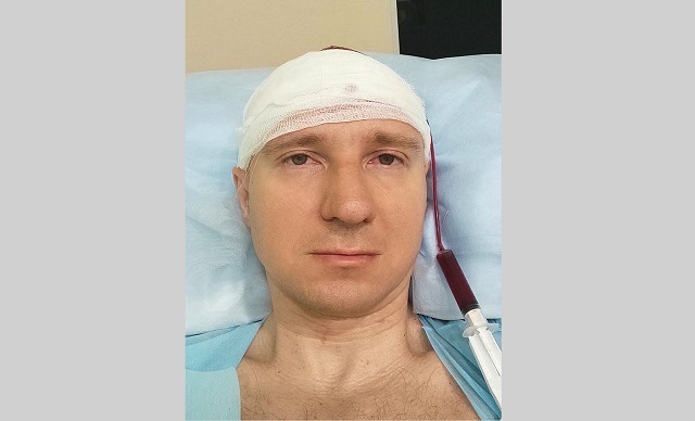 Просверливший себе голову дрелью россиянин раскрыл подробности эксперимента