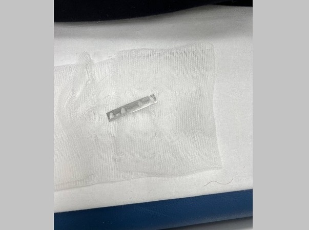 Яр Чаллы табиблары лезвие йоткан хатынның гомерен саклап калган