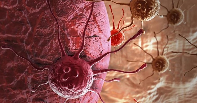 В Минздраве рассказали, как защититься от рака кожи