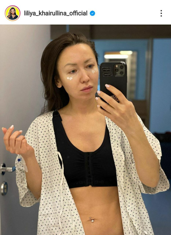 Күкрәкләрен үзгәрткән Лилия Хәйруллина операция бәясен әйтте