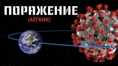 "Поражение легких" репортаж Михаила Любимова о коронавирусе - 7 Дней.