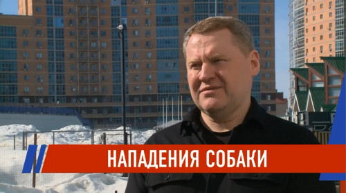 Атака среди бела дня: собака набросилась на ребёнка